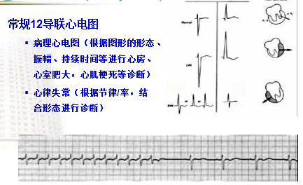 心电图诊断 ppt电子版学习资料下载