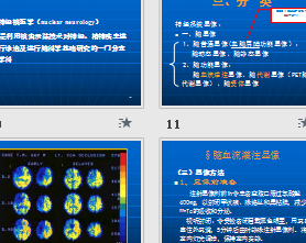 神经系统显像学习资料电子文档ppt