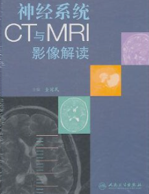 神经系统CT与MRI影像解读pdf电子版